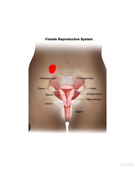 Area of pain is red dot 