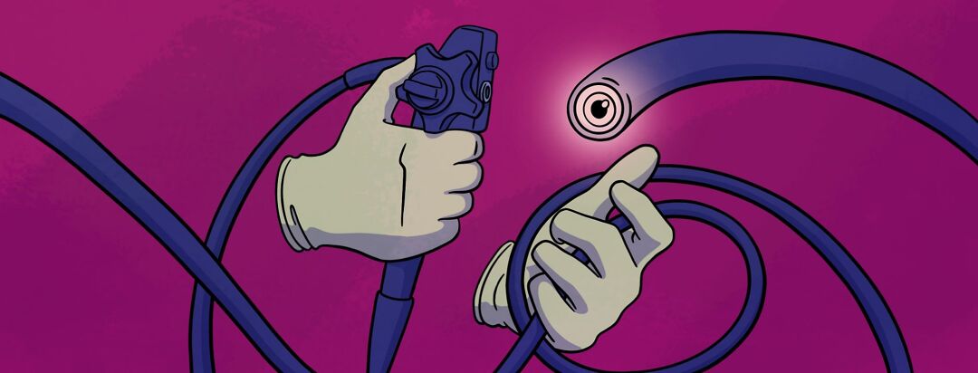 Why I’m Afraid of Getting Another Colonoscopy image