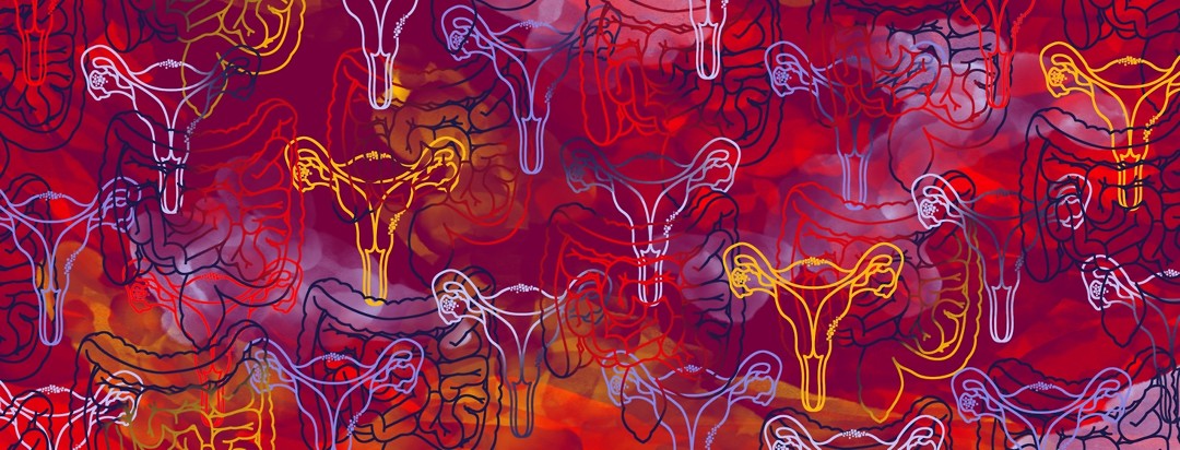 Overlapping outlines of uteruses and GI tracts are set against a red, maroon, purple, and yellow background.