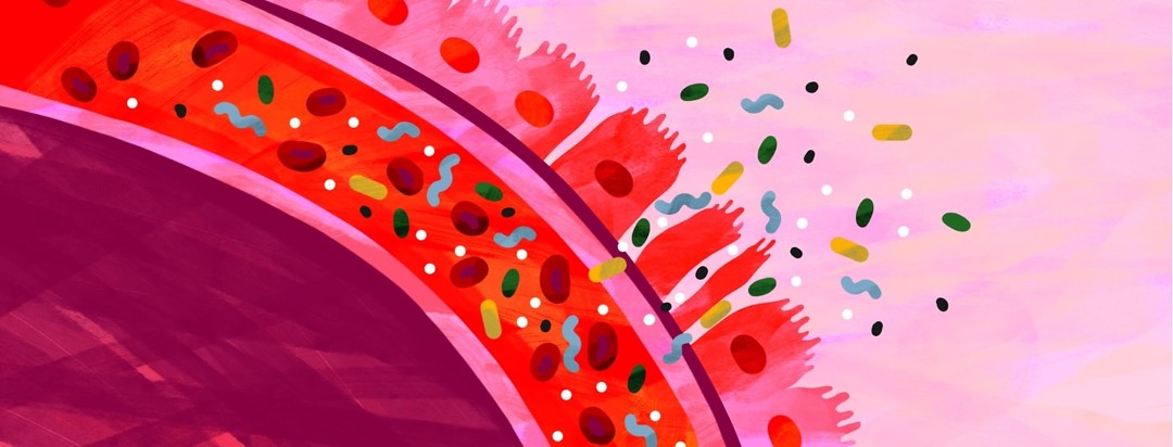 A brightly-colored leaky gut is shown being permeated by differently-colored particles.