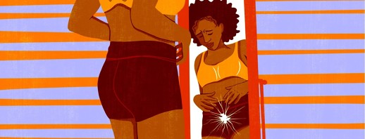 Community Views On The Link Between IBS and Endometriosis image